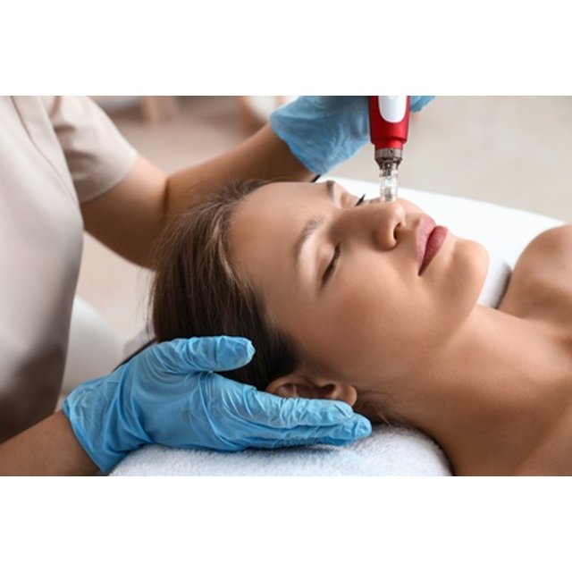 1 sesión de dermapen con ADN de salmón en contorno de ojos