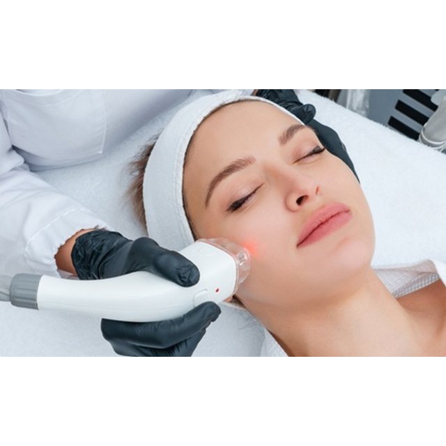 Limpieza facial completa con microdermoabrasión o peeling con ultrasonidos