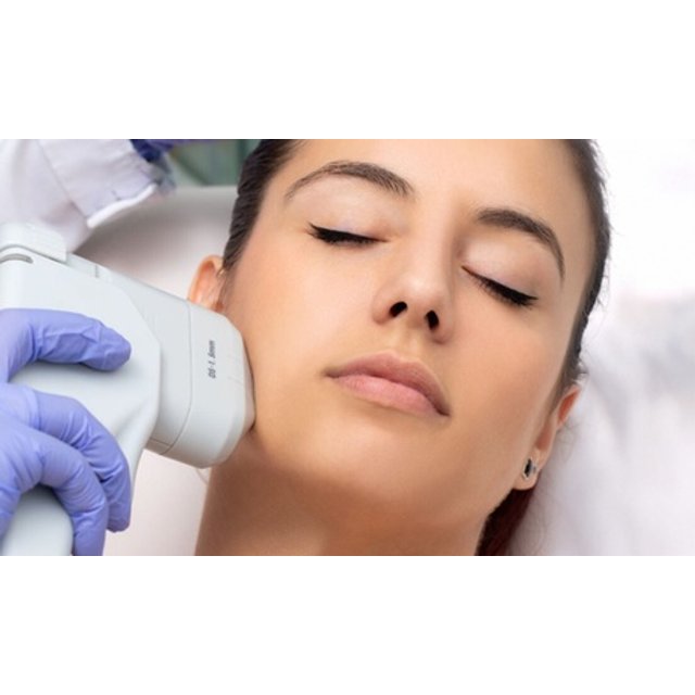 1 sesión de HIFU con vitaminas y fotolifting en zona facial a elegir