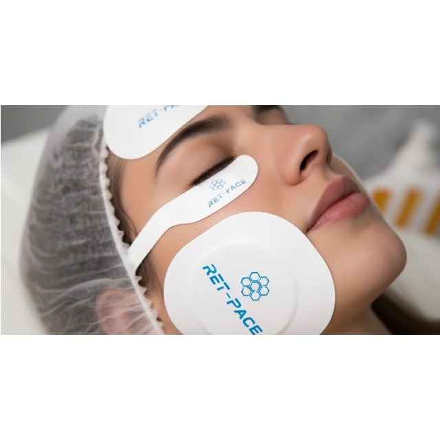 Facial - Ultherapy / Ultrasonido