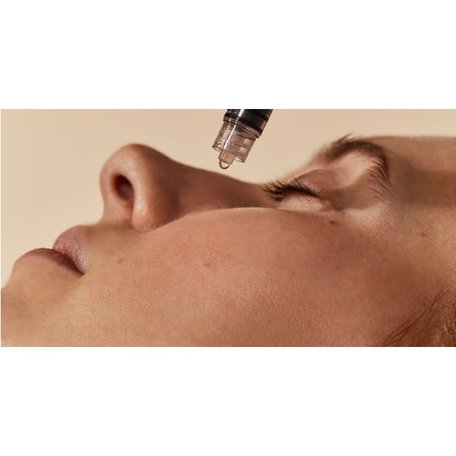 Facelift - Non-Surgical