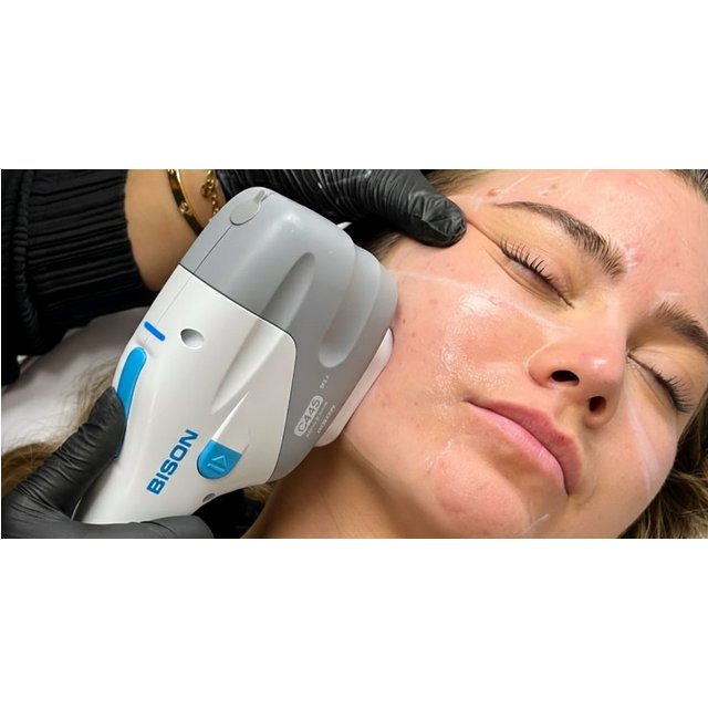 Transform Your Appearance with Non-Surgical HIFU Options