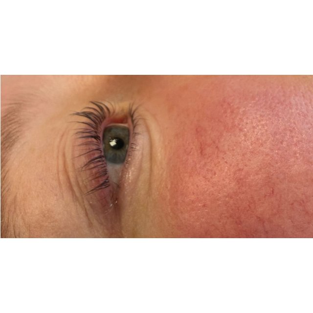 Wimpern- und Augenbrauen-Lifting