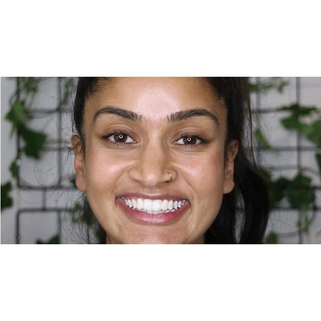 Premium 60-Minute Teeth Whitening (Minimum 8 Shades Lighter)