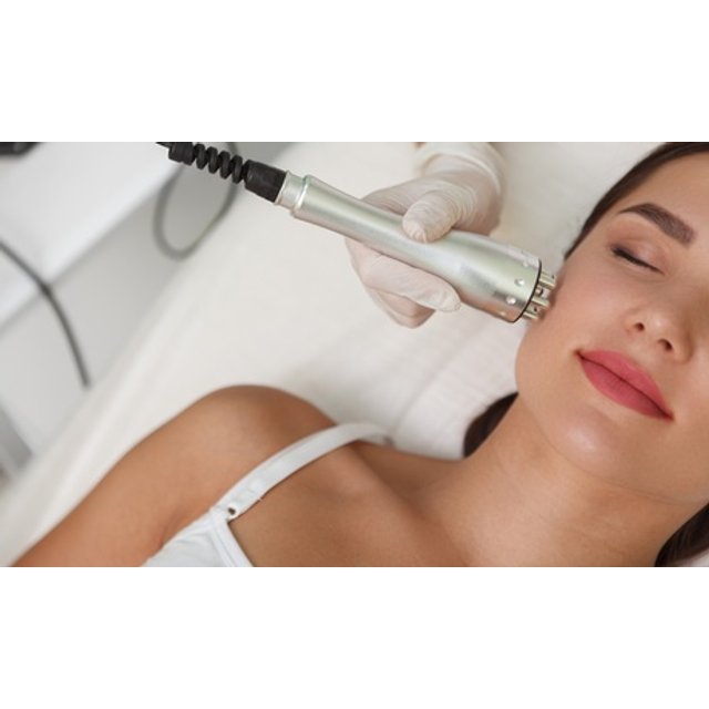 2 sesiones de radiofrecuencia facial Indiba 448