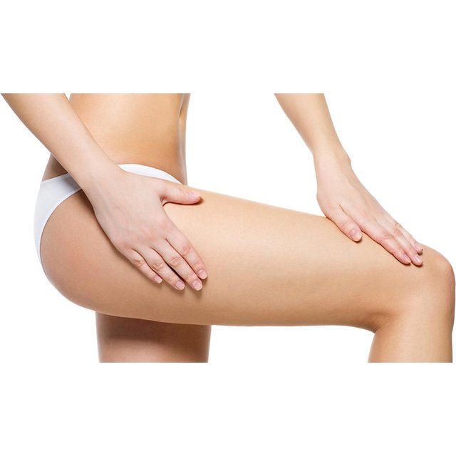 Laser Lipolysis £35