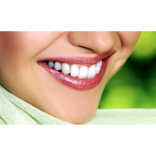 1 sesión de blanqueamiento dental con limpieza bucal