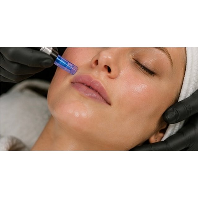 Microneedling or Dermaplaning…