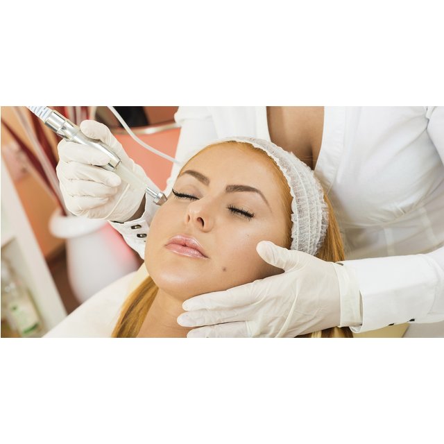 30-Minute Microdermabrasion