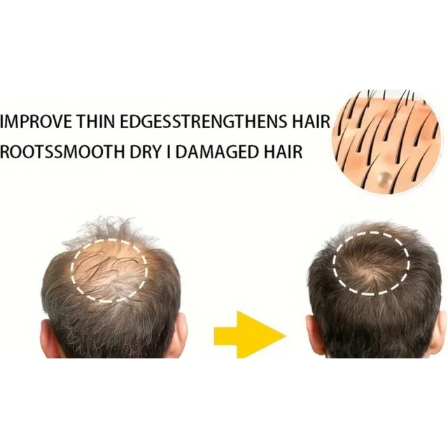 Up to 73% Off Laser Hair Therapy Treatment for Regrowth