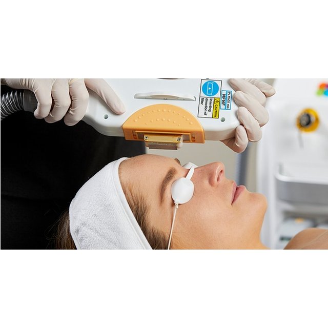 IPL Photo Facial