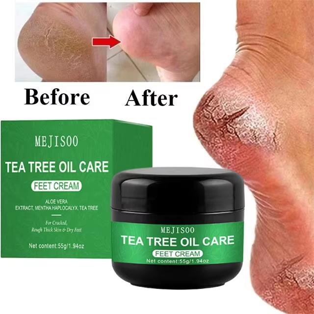 Kräuter Anti Riss Fußcreme Fersenriss Reparaturprodukte Peeling Entfernung abgestorbener Haut Weichmachend Feuchtigkeitsspendend Glatte Hautpflege white