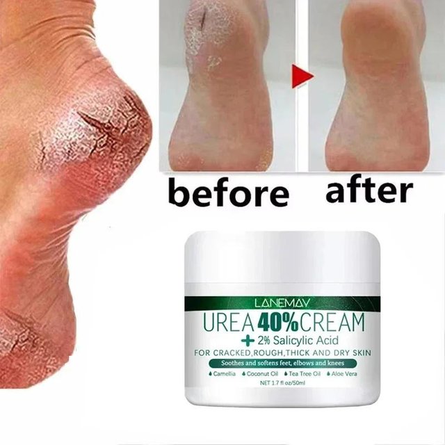 Kräuter Anti Riss Fußcreme Fersenriss Reparaturprodukte Peeling Entfernung abgestorbener Haut Weichmachend Feuchtigkeitsspendend Glatte Hautpflege