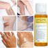 Yellow Peeling Oil Dark Skin Bleaching Remove Arm Knee Legs Melanin Body Exfoliation Brightening Whitening Beauty S