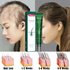 Fast 2023 Biotin Hair Growth Oil Hair Regrowth Serum Hair Thinning Treatment Hair Growth Liquid Anti-Hair Loss
