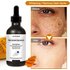 Face Freckle Whitening Serum Turmeric Oil Fade Dark Spot Brighten Removal Pigment Melanin Correcting Essence Beauty