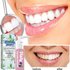 Blueberry Brightening Whitening Teeth, Beautifies Tooth Stain, Whitens Bad breath, Brightens Gingivals, and No