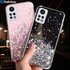 Luxury Bling Glitter Star Case For Xiaomi Redmi Note 11 Pro 11S 10S 10 9 8 9T 9A 8T Mi 12 12X 11 Lite NE 5G Poco X3 M4 P