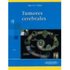 Tumores Cerebrales. Tomo I. Biología De Los Tumores - Aguirre / Sotelo