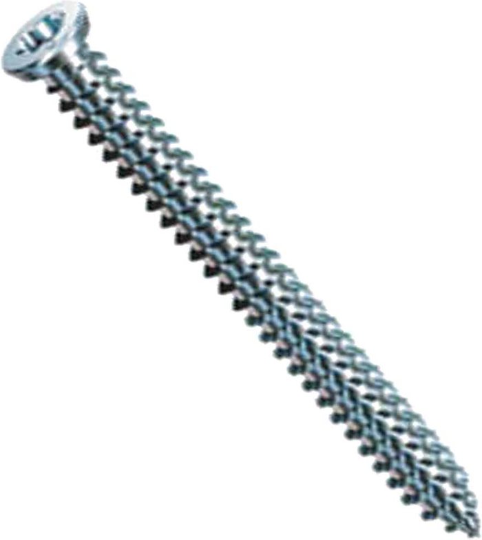 Tooled Up | SPAX Spax RA Countersunk Torx Frame Anchor Screws 7.5mm 60mm Pack of 100 SPAX Spax RA Countersunk Torx Frame Anchor Screws 7.5mm 60mm Pack of 100