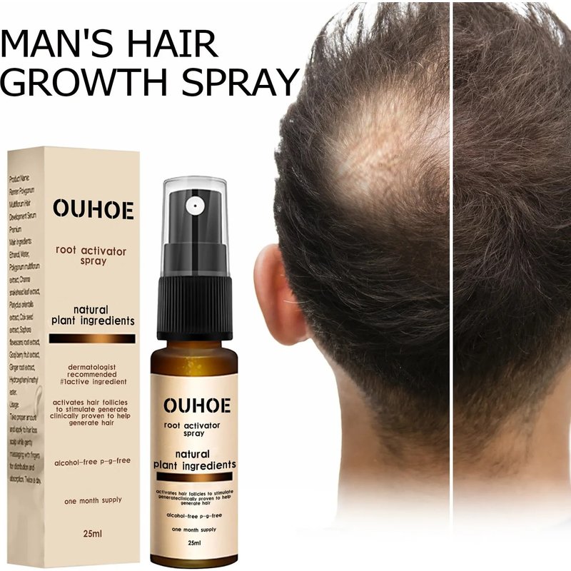 Hair Loss Treatment Spray Nourishing Regrowth Root Thicken Anti Fall Prevent Baldness Repair Damage Grow Hair Essence Spray 25ml
