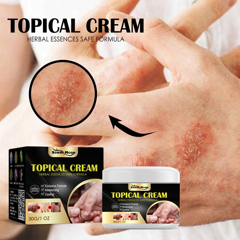 south moon anti-itch cream for hands and feet, skin dry, itchy, itchy, mosquito bites, anti-itch cream