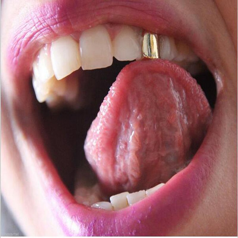 Hip Hop Gold Grillz Single Tooth - Gold Plated Dental Jewelry For Men & Women - U-Shaped Design In Gold, Silver, Rose Gold & Gunmetal