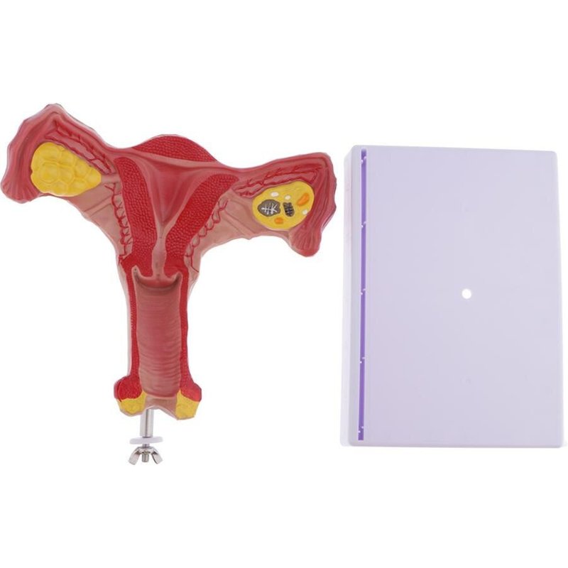 Modèle Anatomique De L'Ovaire, Modèle D'Utérus Féminin Bilatéral 1:1