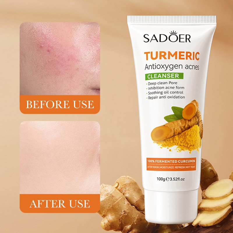 SADOER Turmeric Anti Oxygen Acne Pore Cleansing Milk Skincare Products